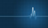 pic of heartbeat  - digital creation of an EKG chart showing heartbeat - JPG 