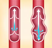 stock photo of vein  - veins of the person under varicose - JPG 